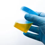 Flying Under the Radar: Leveraging Synthetic Urine to Outsmart Drug Tests