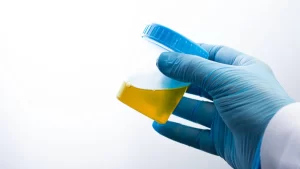 Flying Under the Radar: Leveraging Synthetic Urine to Outsmart Drug Tests