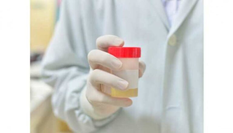 Heard of Synthetic urine test?